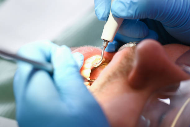 Best Emergency Dental Care for Broken or Chipped Teeth in Oregon, WI