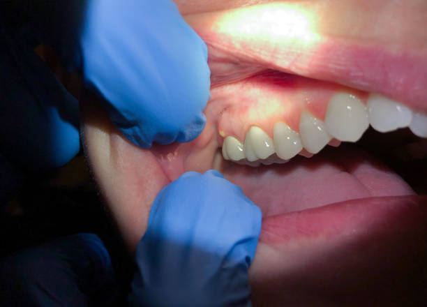 Best Emergency Denture Repair in Oregon, WI