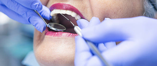 Best Emergency Root Canal Treatment in Oregon, WI